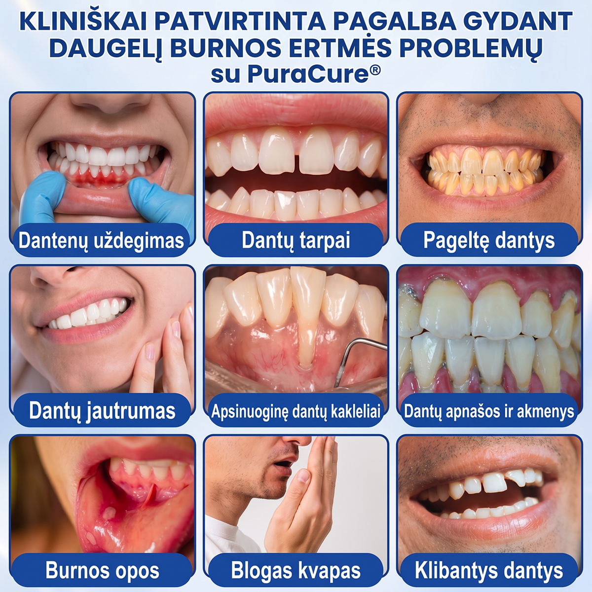 🦷 𝐏𝐮𝐫𝐚𝐂𝐮𝐫𝐞® DANTENŲ ATKŪRIMAS – Periodonto audinių regeneracijos gelis 🧂