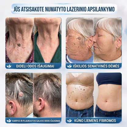 PuraCure® 👩‍⚕️ 7 dienų odos išaugų ir dėmių šalinimo pieštukas – neskausmingas, be randų, profesionalus ritininis aplikatorius