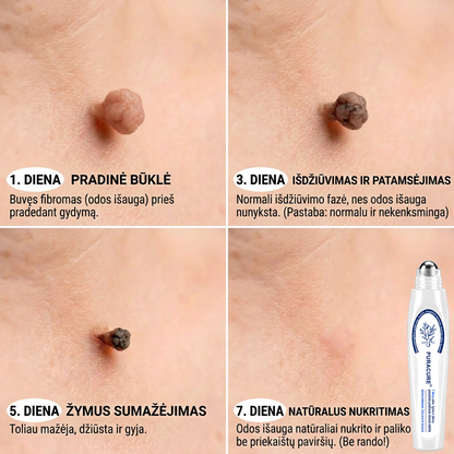 PuraCure® 👩‍⚕️ 7 dienų odos išaugų ir dėmių šalinimo pieštukas – neskausmingas, be randų, profesionalus ritininis aplikatorius